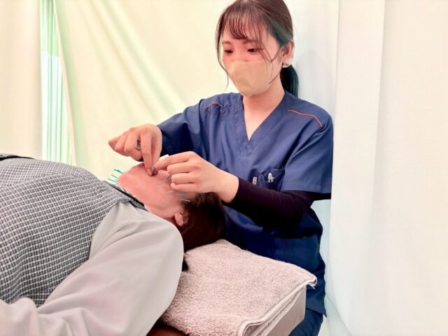 【美顔鍼って何が違うの？肌の内側から整える美容ケア✨】
